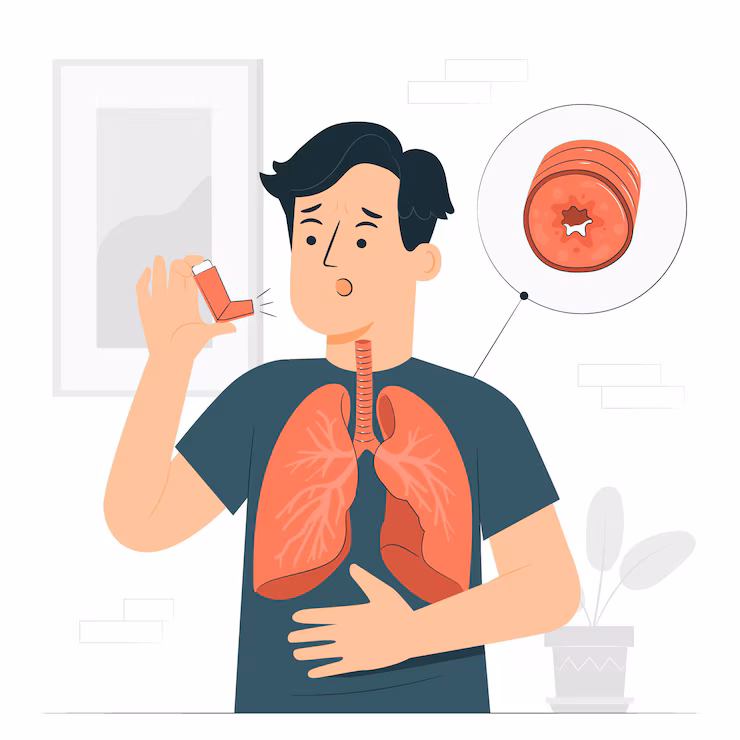 Homeopathic Treatment for Asthma — Dr. Manish Yadav, Sevatwa Clinic